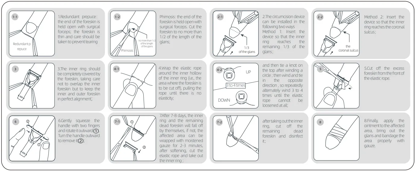Disposable  Sterile  Circumcision  Device-08.webp 
